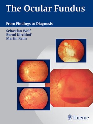 cover image of The Ocular Fundus